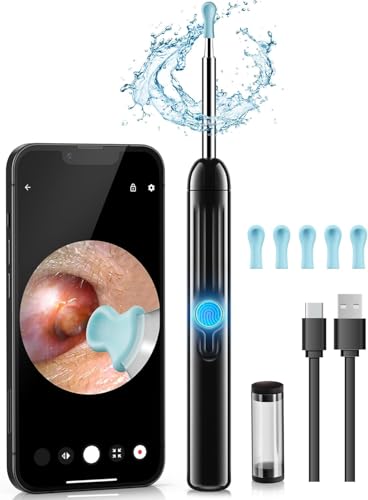 Jegoat Ear Wax Removal, 1080P HD Scope and 6 LED Lights, Ear Cleaner with Camera, Ear Cleaning Kit - Earwax Remover Tool with 5 Spoon (Onyx)